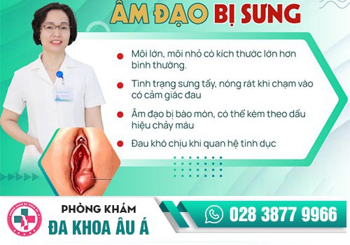Vùng kín bị sưng 1 bên mép là bệnh gì?